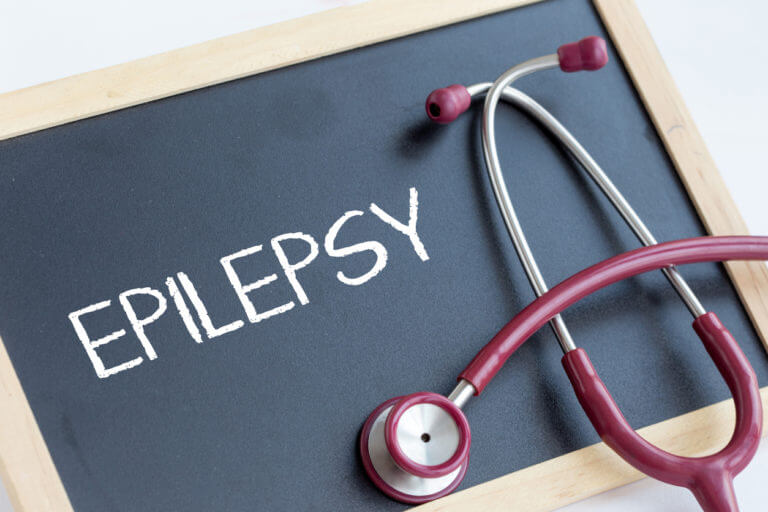 Epilepsy Research