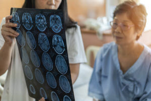Doctor showing her patient brain scans