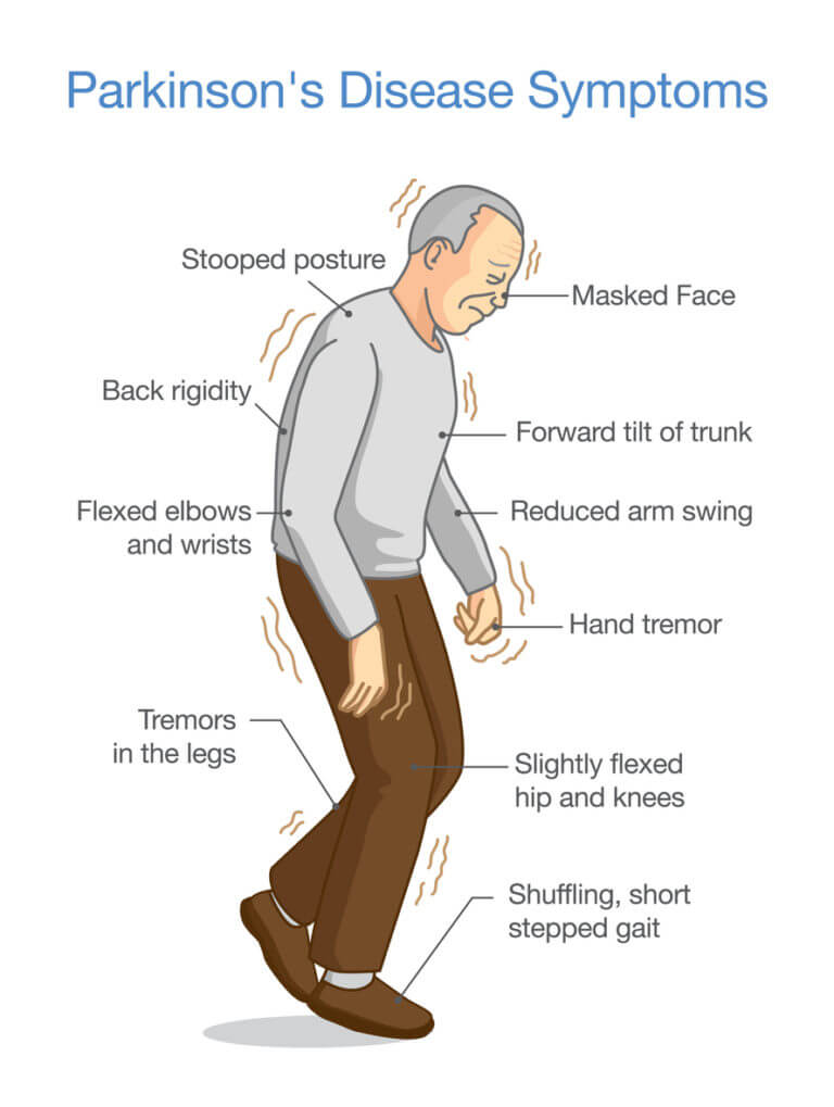 Parkinson's Disease Symptoms